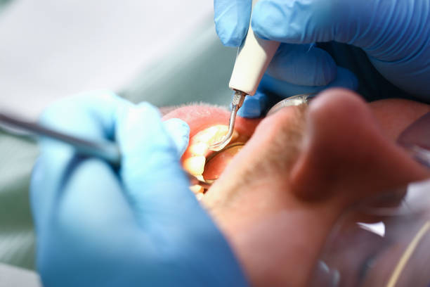 Best Weekend Emergency Dental Services in Little River Academy, TX