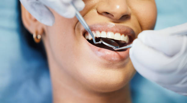 Best Emergency Wisdom Tooth Extraction in Little River Academy, TX